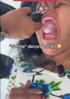 Hindistan’da Sinüsleri Balonla Açma Yöntemi