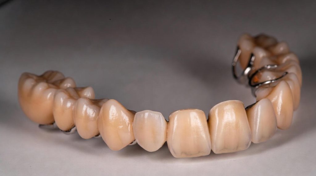 GSS Diş Köprüsünü Karşılıyor mu ?